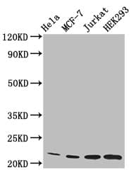 HIST1H1C Antibody