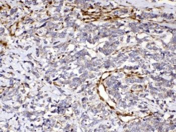 Polyclonal Rabbit anti-Human CYGB / Cytoglobin Antibody (IHC, WB)