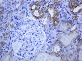 KRT5 / CK5 / Cytokeratin 5 Antibody (aa1-273, clone OTI1E7)