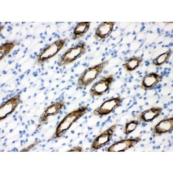 AQP2 / Aquaporin 2 Antibody (aa241-271)
