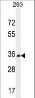 OR10H1 Antibody (aa245-273)