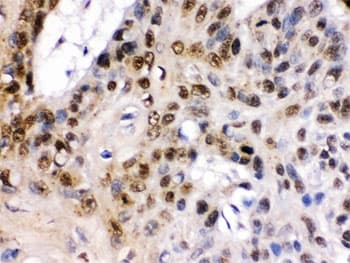 Polyclonal Rabbit anti-Human TCF7L1 / TCF-3 Antibody (IHC, WB)