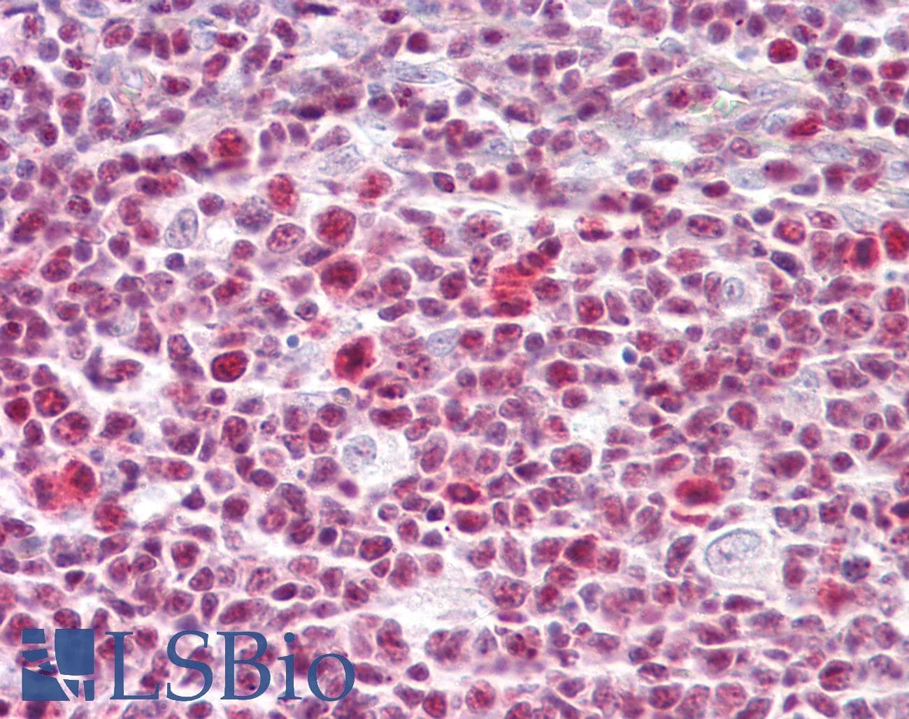 IHC-plus™ Polyclonal Rabbit anti-Human IKZF3 / AIOLOS Antibody (aa350-400, IHC, WB)