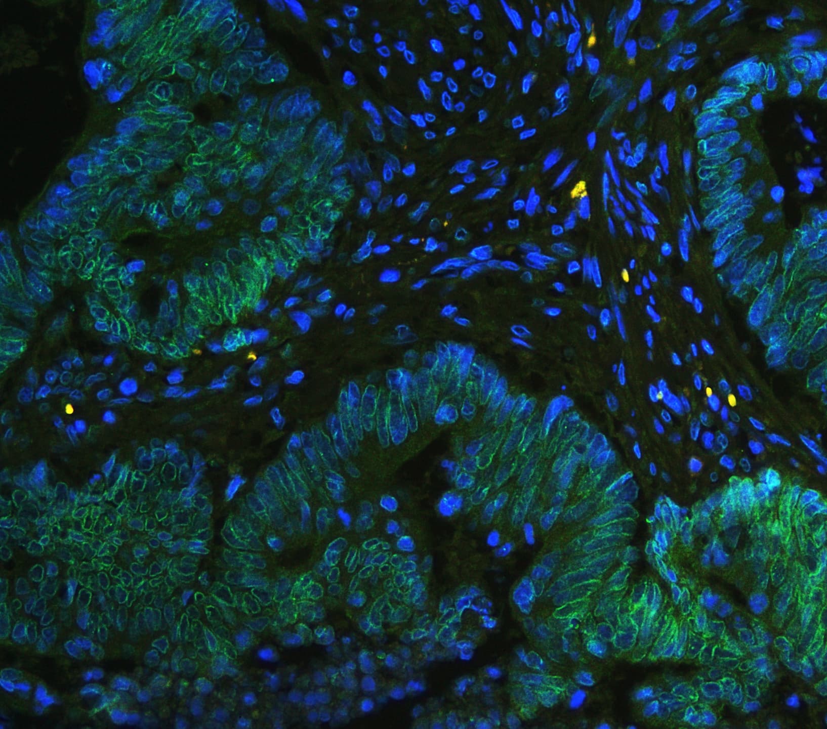 TPR Antibody