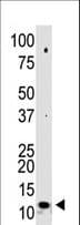 SUMO2 Antibody (N-Terminus)