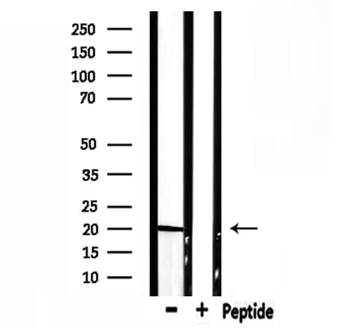 Polyclonal Rabbit anti-Human ARF1 Antibody (WB)