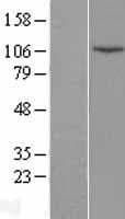 LIG4 / DNA Ligase IV Protein (Over-Expression Lysate Myc-DDK (Flag))