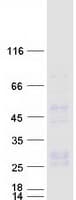 Human CD27L / CD70 Protein (Recombinant Myc-DDK (Flag))