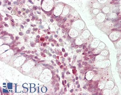 POU3F1 / OCT6 Antibody (aa361-410)