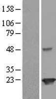 JOSD2 Protein (Over-Expression Lysate Myc-DDK (Flag))