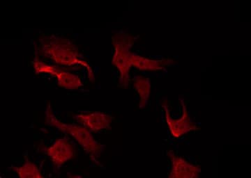 AKT1 Antibody (phospho-Thr308)