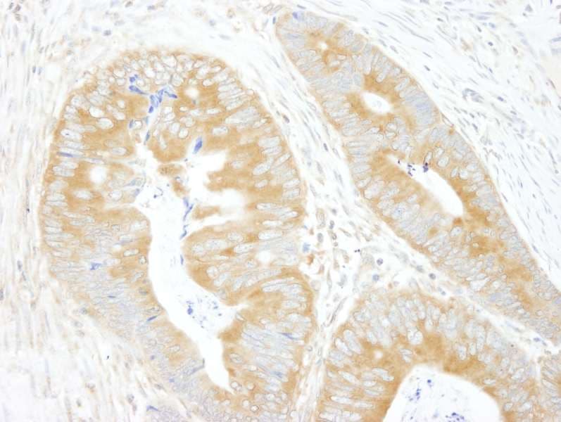 Polyclonal Rabbit anti-Human EIF3A Antibody (aa860-910, IHC)