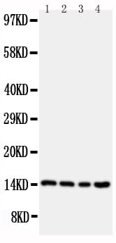 CSTB / Cystatin B / Stefin B Antibody (aa26-45)