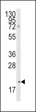 BMF Antibody (aa115-150)