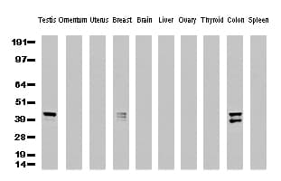 KRT19 / CK19 / Cytokeratin 19 Antibody (aa240-390, clone UMAB2)