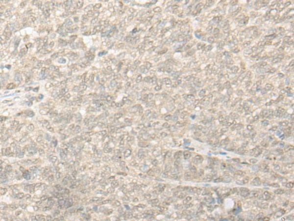 COMT Antibody