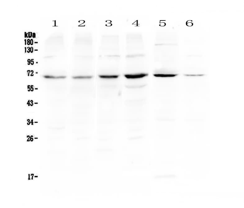 PIAS3 Antibody