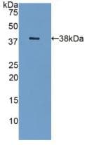 LGALS8 / Galectin 8 Antibody (aa1-317)