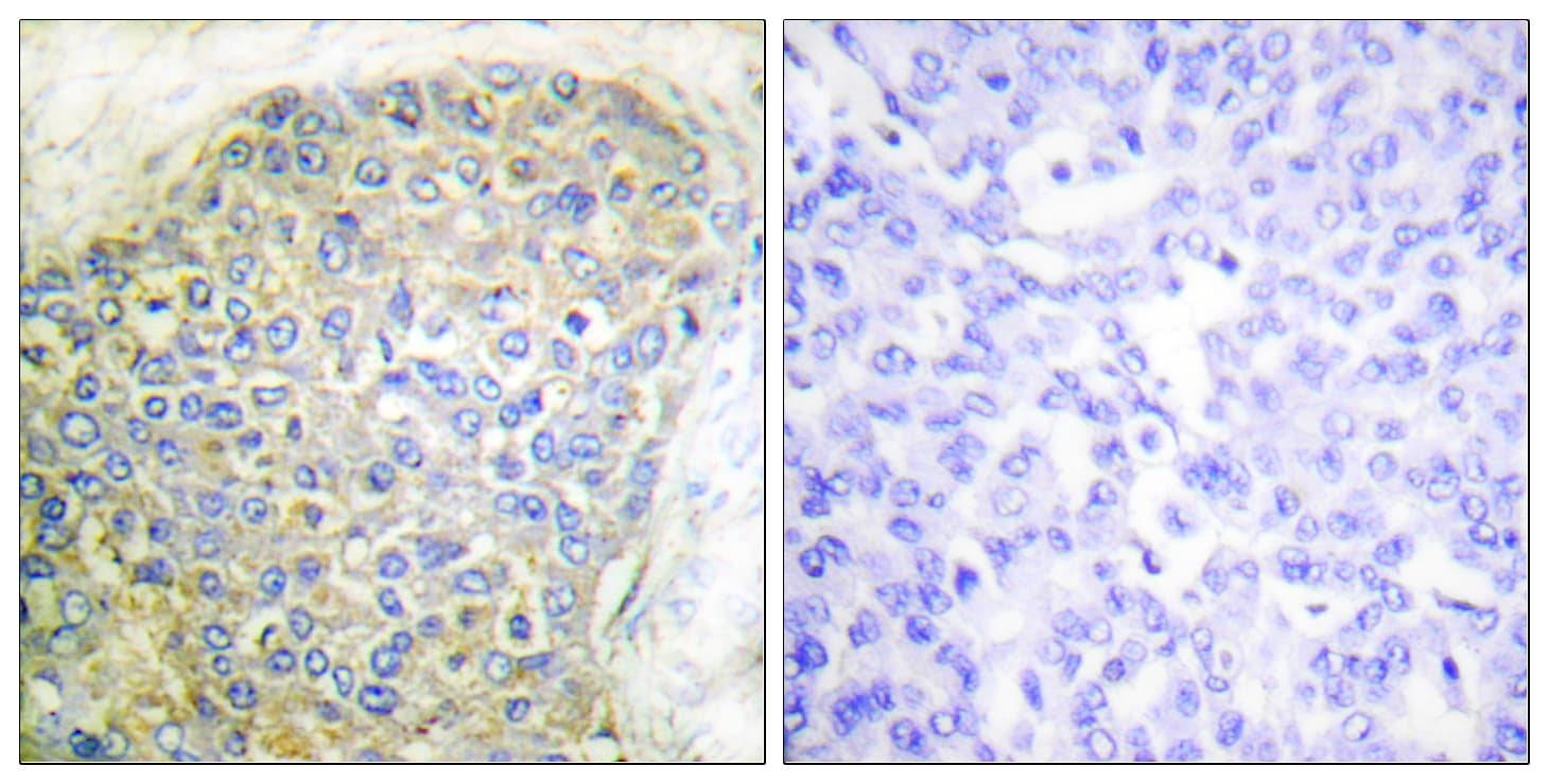 LIPE / HSL Antibody (aa520-569)