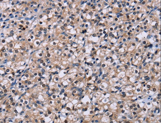 Polyclonal Rabbit anti-Human NR1D1 Antibody (IHC)