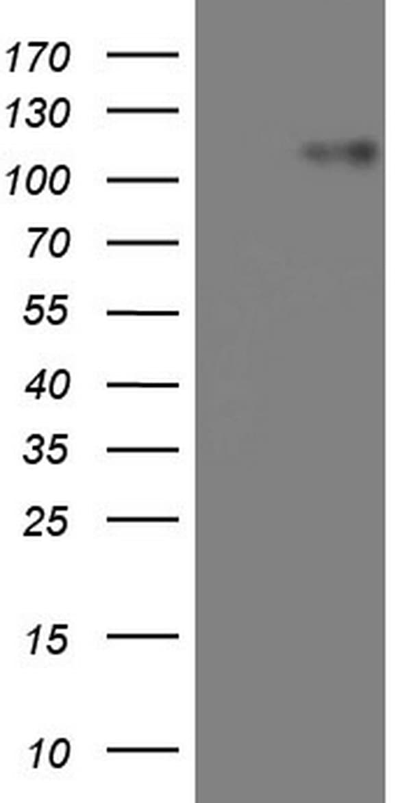 Monoclonal Mouse anti-Human BSAC / MKL1 Antibody (clone OTI3C8, aa165-397, WB)