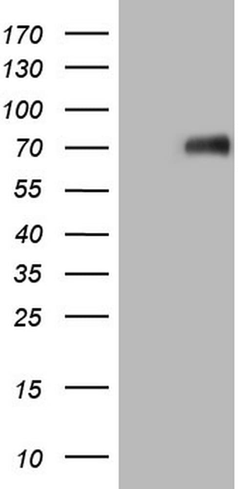 Monoclonal Mouse anti-Human CSF1 / MCSF Antibody (clone OTI8E1, aa223-496, IHC, WB)