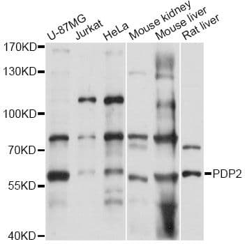 Polyclonal Rabbit anti-Human PDP2 Antibody (IHC, WB)