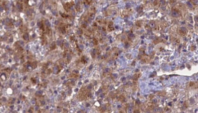 GABRB2 Antibody