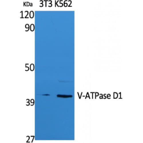 ATP6V0D1 Antibody (Internal)