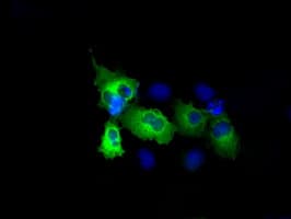 RIP1 / RALBP1 Antibody (clone OTI6C6)