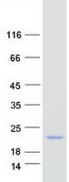Human CLDND2 Protein (Recombinant Myc-DDK (Flag))