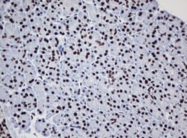 DCPS Antibody (clone OTI1E6)