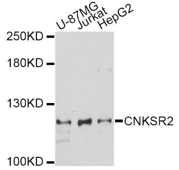 Polyclonal Rabbit anti-Human CNKSR2 Antibody (WB)