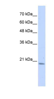 Polyclonal Rabbit anti-Human PFDN6 / HKE2 Antibody (N-Terminus, WB)