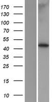 MBOAT7 / BB1 Protein (Over-Expression Lysate Myc-DDK (Flag))