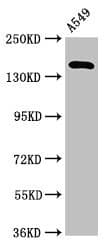 A2ML1 Antibody