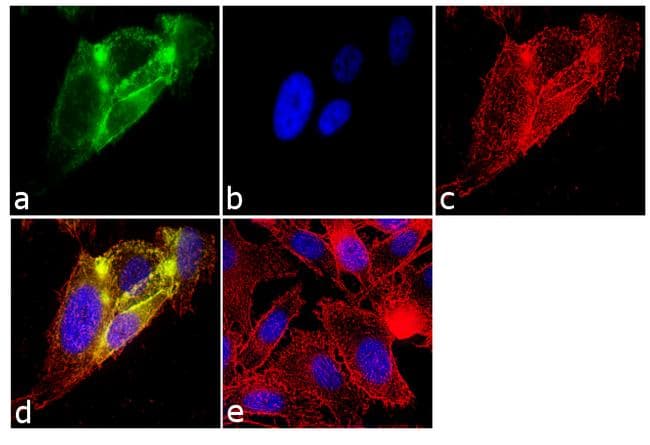 FSH Antibody (clone P2B4)
