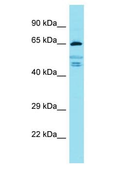FIGNL2 Antibody (aa233-282)