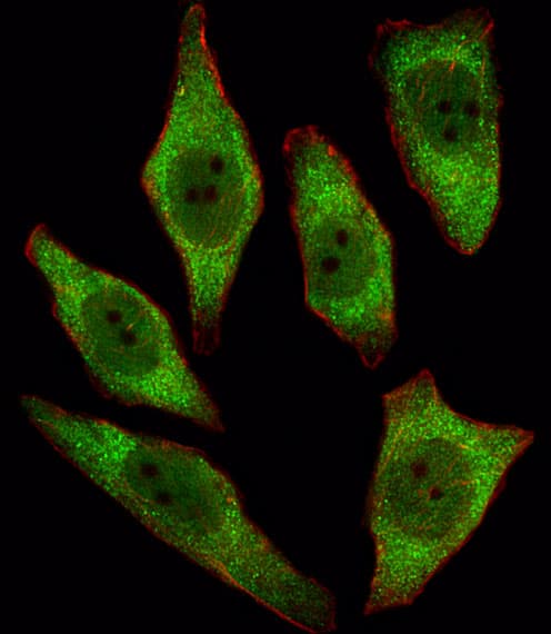 APRT Antibody (aa12-40)