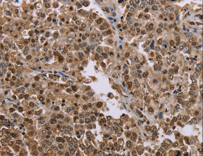 MRGX1 / MRGPRX1 Antibody