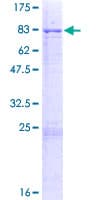 Human MLKL Protein (Recombinant GST)