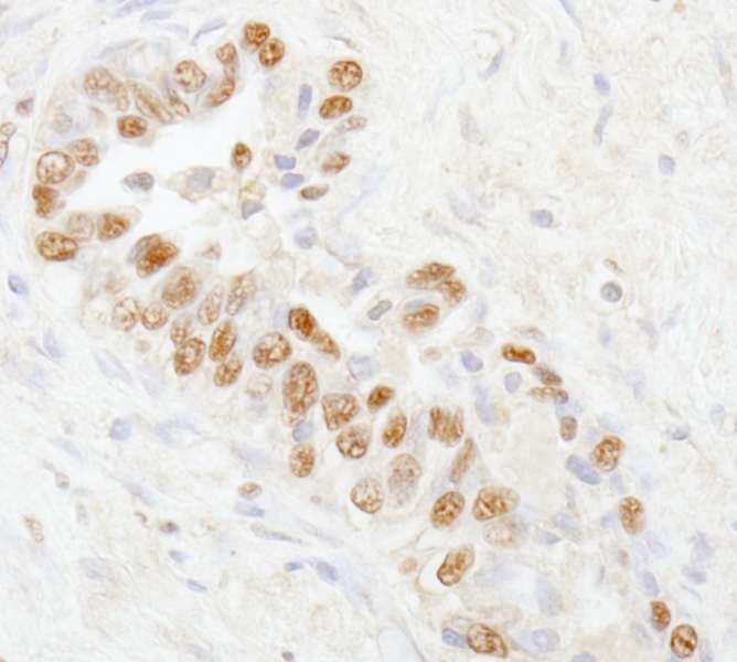 UBA1 / UBE1 Antibody (aa850-900)