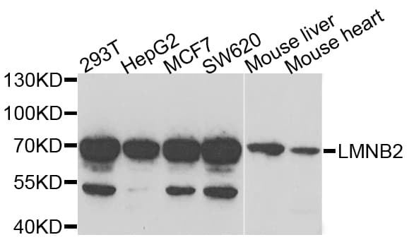 LAMB2 / Laminin Beta 2 Antibody