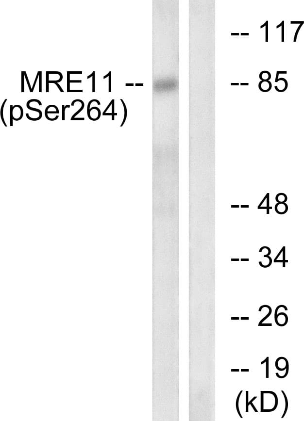 MRE11A / MRE11 Antibody (phospho-Ser264)