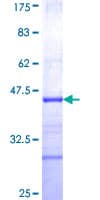 Human FLVCR / FLVCR1 Protein (Recombinant GST, N-terminus)