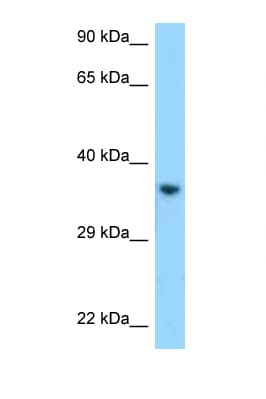KIR2DL1 / CD158a Antibody (C-Terminus)