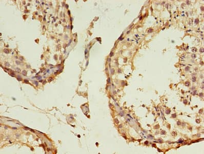 Polyclonal Rabbit anti-Human B3GNT5 Antibody (IHC)