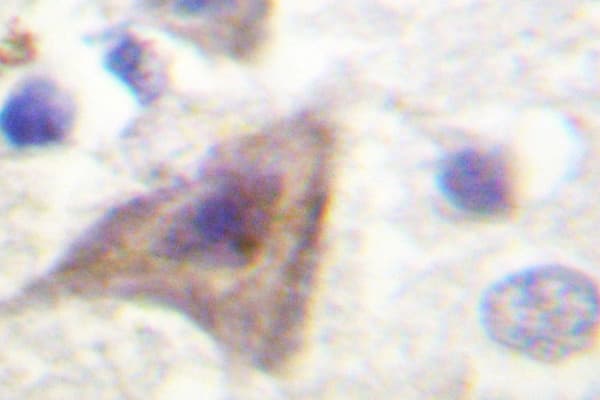 AKT1S1 / PRAS40 Antibody (Pro240)