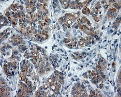 PTPRE / PTP Epsilon Antibody (clone OTI5E8)