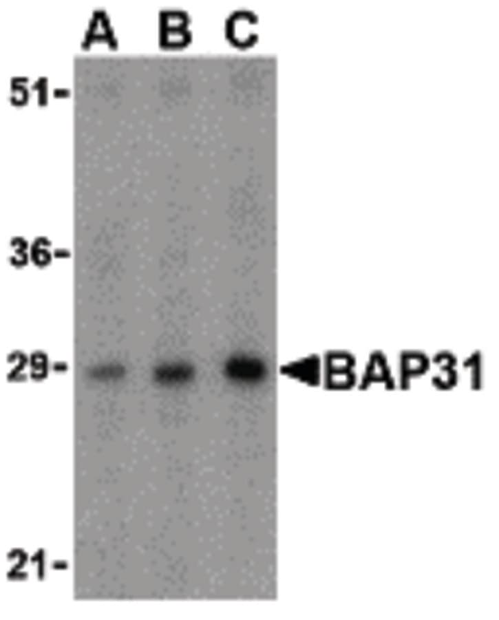 IHC-plus™ BCAP31 / BAP31 Antibody